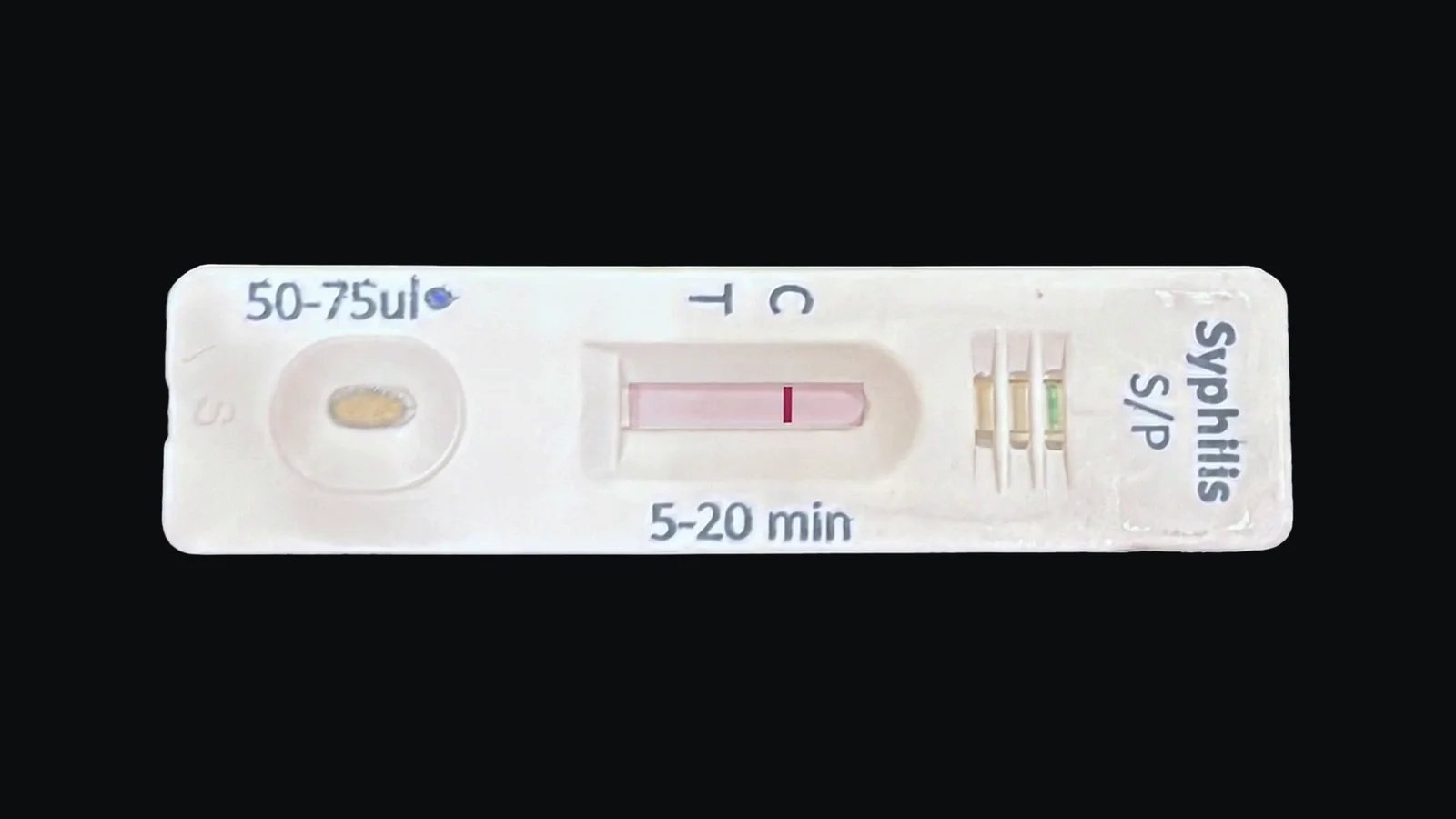 A Reckon Syphilis Card test card after the test has run: sample in the well and the control line under C